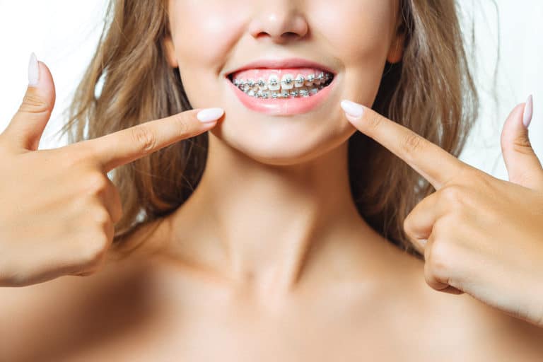 How Much Do Braces Cost In Toronto? Wired Orthodontics