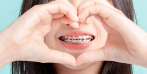 Bigstock Close Up Lover Dental Braces O 380957309