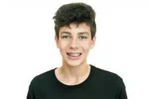 Metal Braces Benefits and Effectiveness