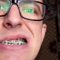 Preventing Orthodontic Emergencies Toronto