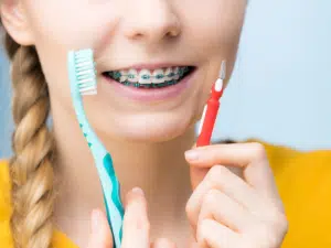 Person with braces holding a toothbrush and interdental brush demonstrating braces cleaning tips