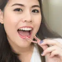 Asian woman smiling while wearing a clear teeth retainer