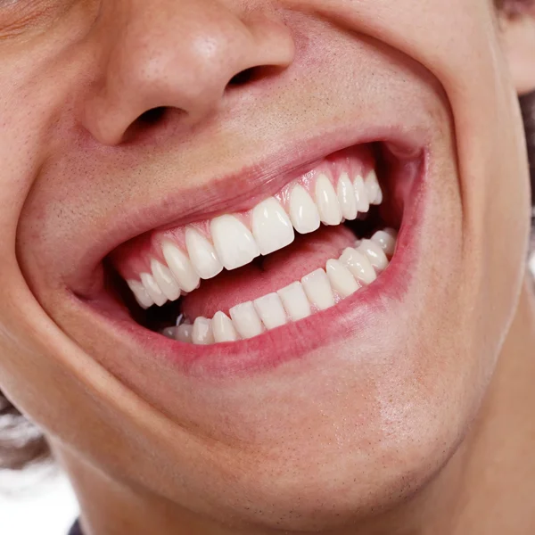 invisalign-cost-toronto-on