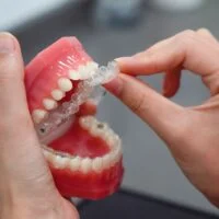 Invisalign Teen Toronto
